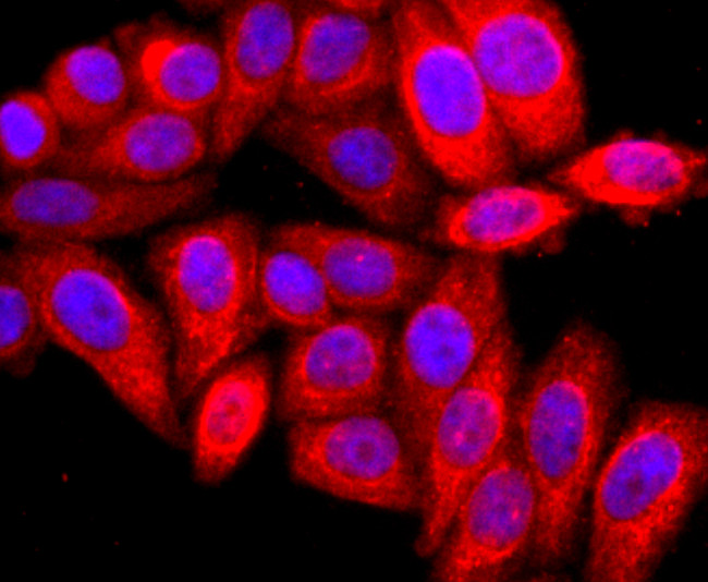 ARF6 Antibody in Immunocytochemistry (ICC/IF)