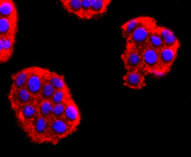 NEFM Antibody in Immunocytochemistry (ICC/IF)