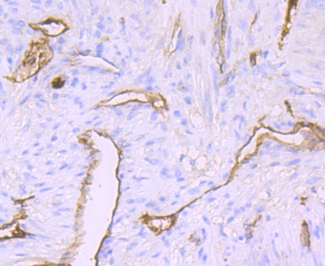 Claudin 5 Antibody in Immunohistochemistry (Paraffin) (IHC (P))