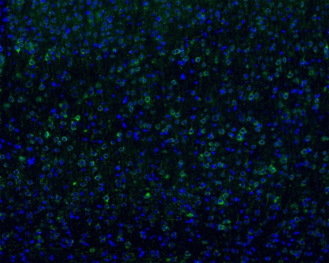 TNFR2 Antibody in Immunohistochemistry (Frozen) (IHC (F))