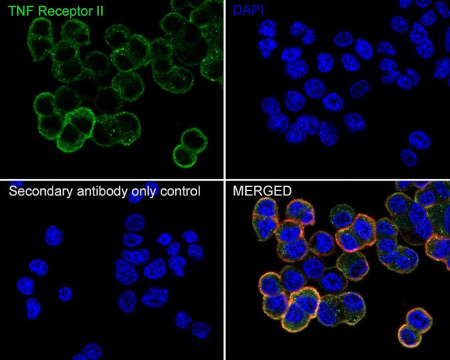 TNFR2 Antibody in Immunocytochemistry (ICC/IF)