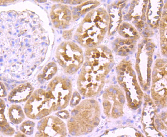 TNFR2 Antibody in Immunohistochemistry (Paraffin) (IHC (P))