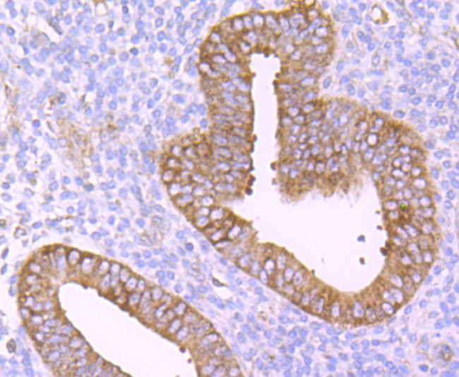 TNFR2 Antibody in Immunohistochemistry (Paraffin) (IHC (P))