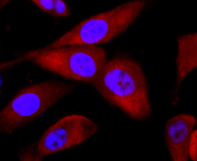 BID Antibody in Immunocytochemistry (ICC/IF)