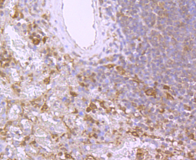 BID Antibody in Immunohistochemistry (Paraffin) (IHC (P))