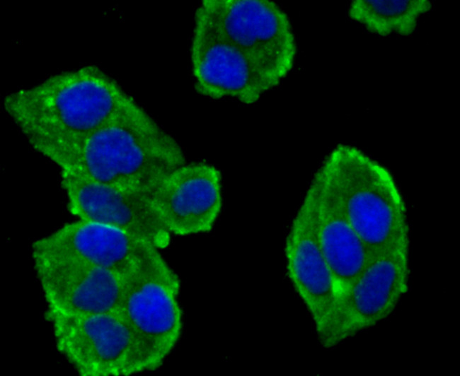 alpha Actinin 4 Antibody in Immunocytochemistry (ICC/IF)