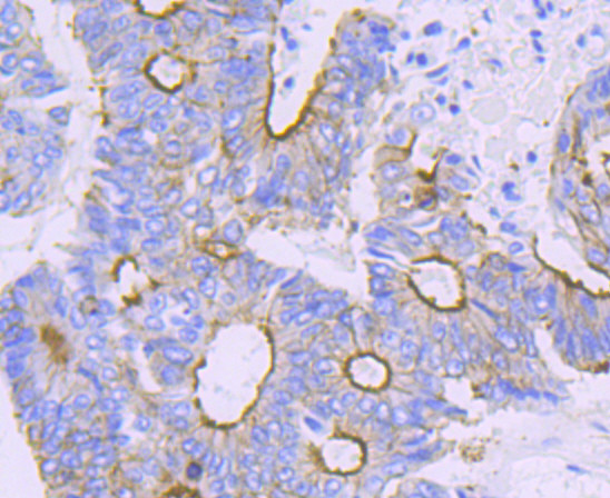 alpha Actinin 4 Antibody in Immunohistochemistry (Paraffin) (IHC (P))