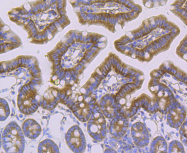 alpha Actinin 4 Antibody in Immunohistochemistry (Paraffin) (IHC (P))