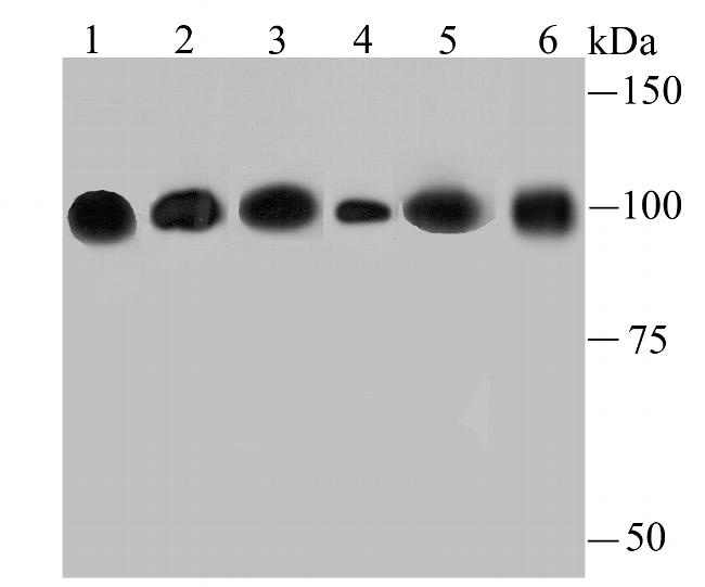 alpha Actinin 4 Antibody in Western Blot (WB)