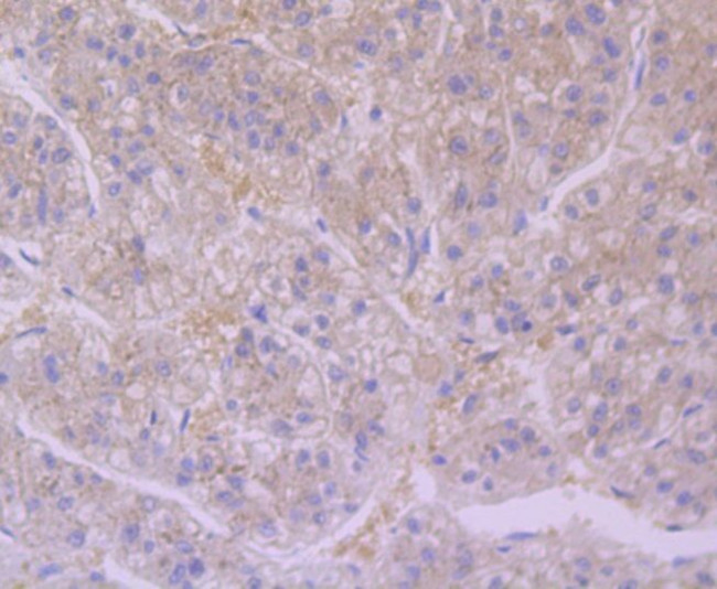 Furin Antibody in Immunohistochemistry (Paraffin) (IHC (P))