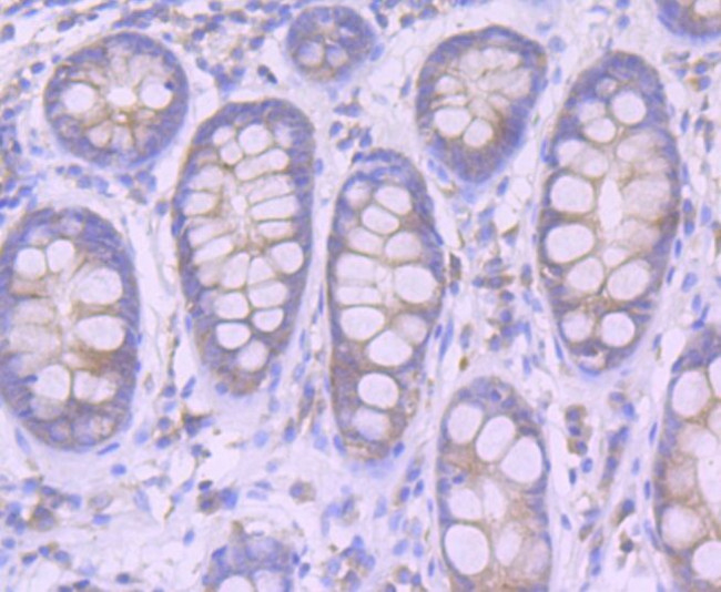 Furin Antibody in Immunohistochemistry (Paraffin) (IHC (P))