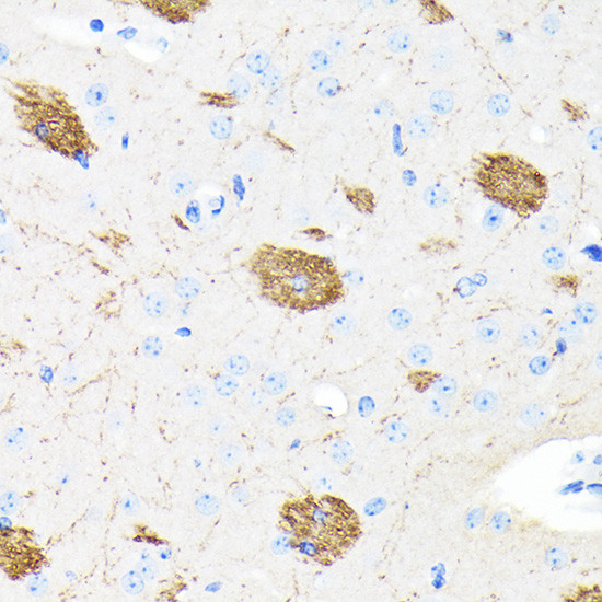 Amyloid Precursor Protein Antibody in Immunohistochemistry (Paraffin) (IHC (P))