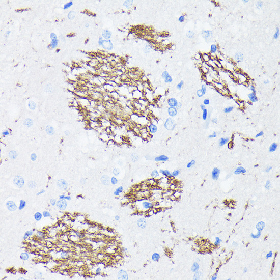 Amyloid Precursor Protein Antibody in Immunohistochemistry (Paraffin) (IHC (P))