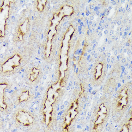 Nectin 2 Antibody in Immunohistochemistry (Paraffin) (IHC (P))