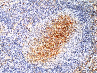 CD14 Antibody in Immunohistochemistry (Paraffin) (IHC (P))