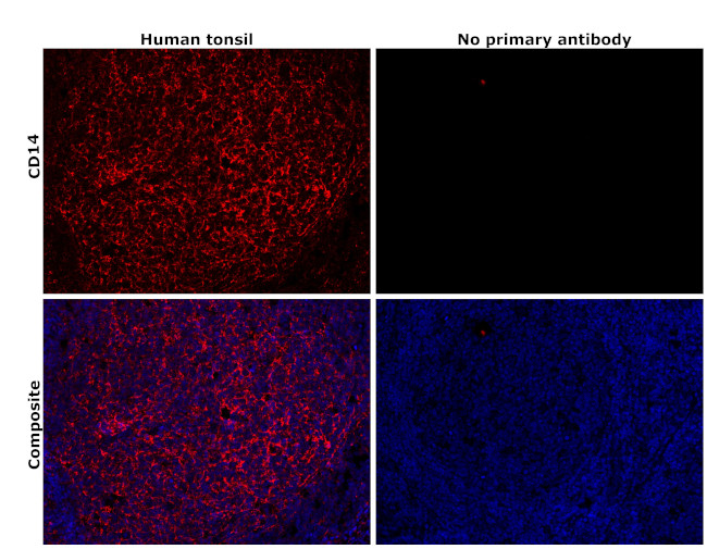 CD14 Antibody in Immunohistochemistry (Paraffin) (IHC (P))