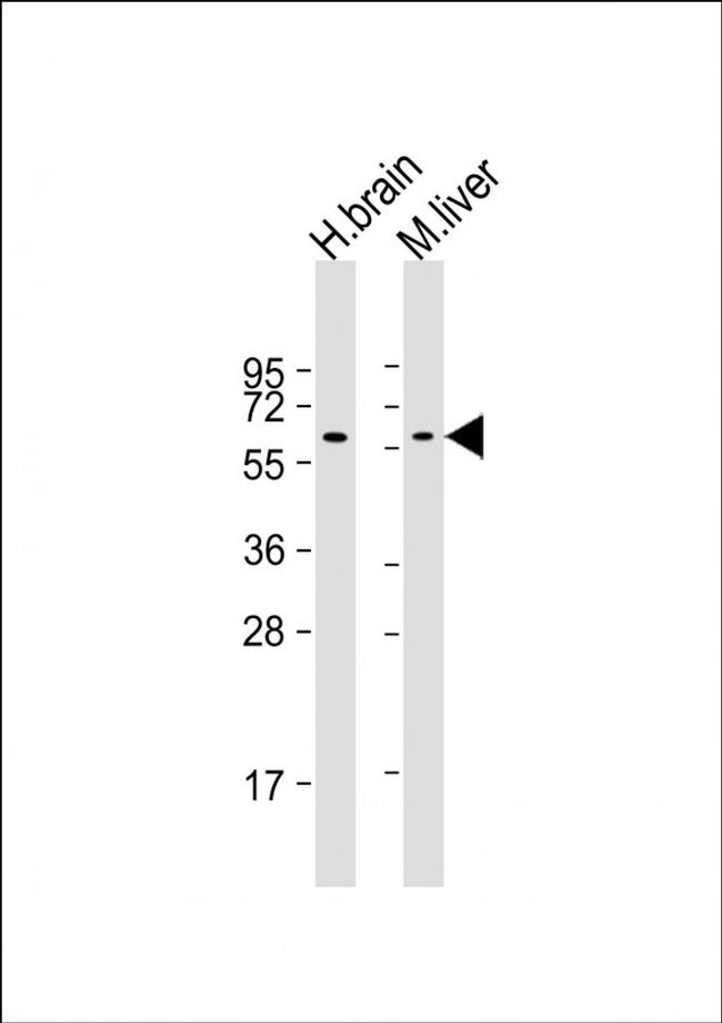 GLS2 Antibody in Western Blot (WB)