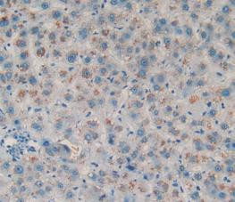 Amphiregulin Antibody in Immunohistochemistry (Paraffin) (IHC (P))