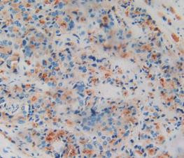 Amphiregulin Antibody in Immunohistochemistry (Paraffin) (IHC (P))