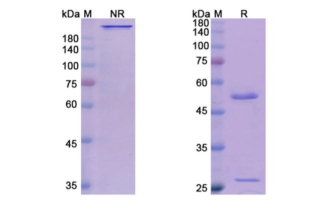 Gatipotuzumab Humanized Antibody in SDS-PAGE (SDS-PAGE)