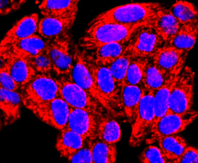 MMP13 Antibody in Immunocytochemistry (ICC/IF)