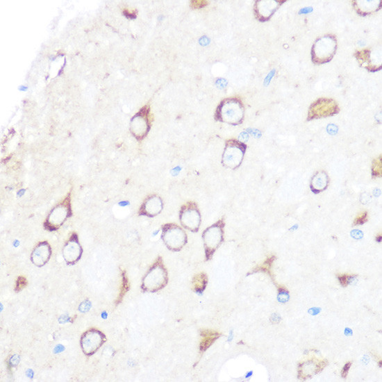 CD204 Antibody in Immunohistochemistry (Paraffin) (IHC (P))