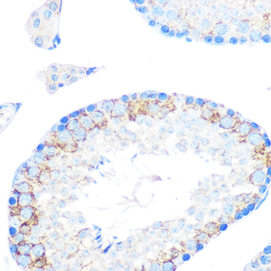 CD204 Antibody in Immunohistochemistry (Paraffin) (IHC (P))