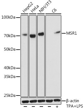 CD204 Antibody in Western Blot (WB)