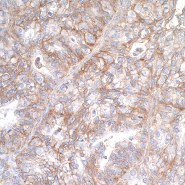 B7-H3 (CD276) Antibody in Immunohistochemistry (Paraffin) (IHC (P))