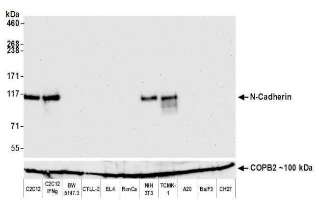 CD325 (N-Cadherin) Antibody in Western Blot (WB)