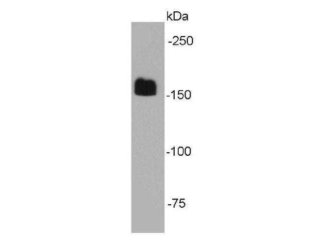 EEA1 Antibody in Western Blot (WB)