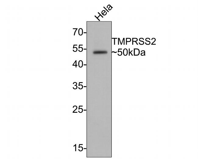 TMPRSS2 Antibody in Western Blot (WB)