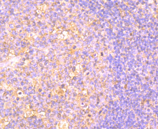 OX40 (CD134) Antibody in Immunohistochemistry (Paraffin) (IHC (P))