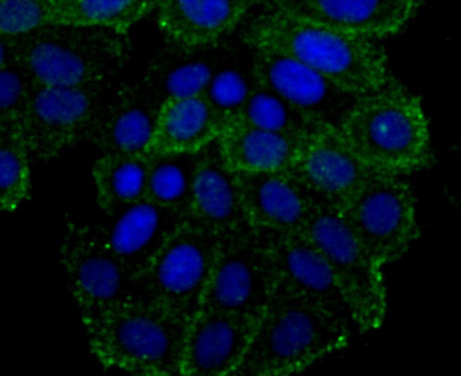 OX40 (CD134) Antibody in Immunohistochemistry (Paraffin) (IHC (P))