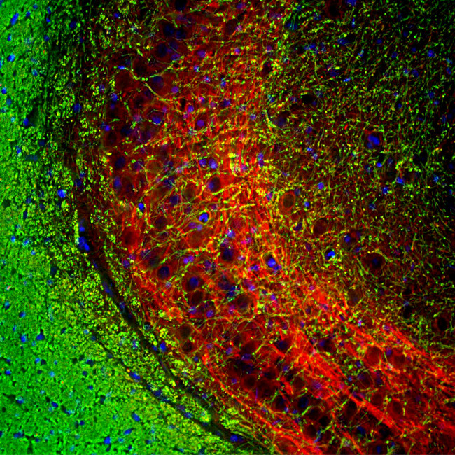 MBP Antibody in Immunohistochemistry (IHC)