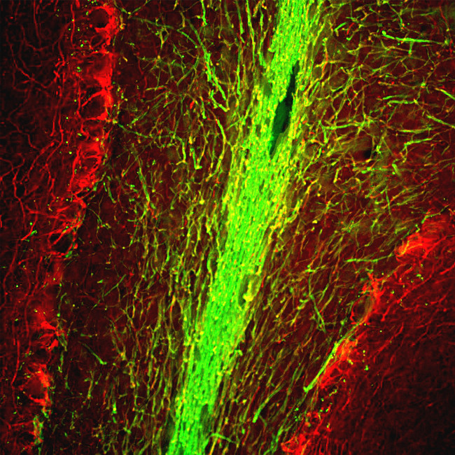 MBP Antibody in Immunohistochemistry (IHC)