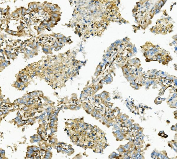 HK1 Antibody in Immunohistochemistry (Paraffin) (IHC (P))