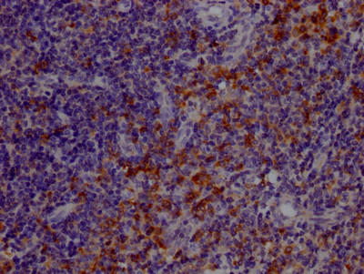 TLR7 Antibody in Immunohistochemistry (Paraffin) (IHC (P))