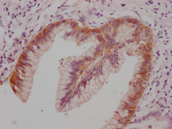 Claudin 18 Antibody in Immunohistochemistry (Paraffin) (IHC (P))