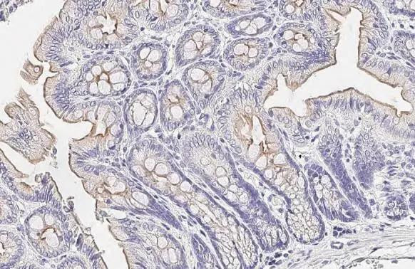 TMPRSS2 Antibody in Immunohistochemistry (Paraffin) (IHC (P))