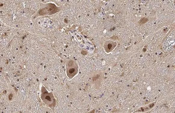 Aromatase Antibody in Immunohistochemistry (Paraffin) (IHC (P))