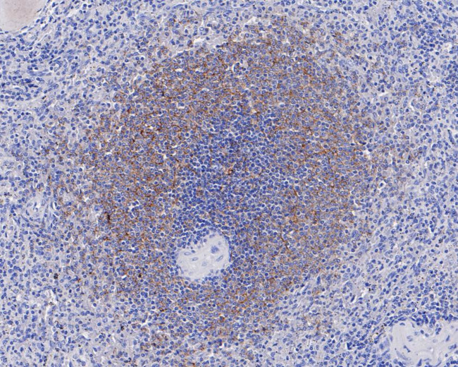 CD35 Antibody in Immunohistochemistry (Paraffin) (IHC (P))