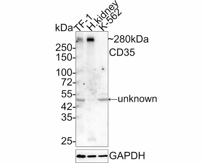 CD35 Antibody in Western Blot (WB)