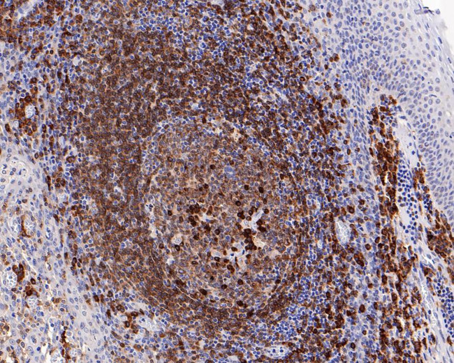 CD79a Antibody in Immunohistochemistry (Paraffin) (IHC (P))