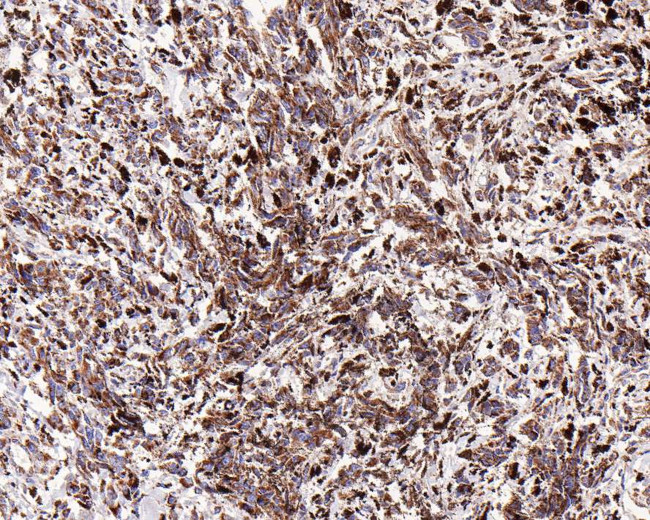 CD116 Antibody in Immunohistochemistry (Paraffin) (IHC (P))