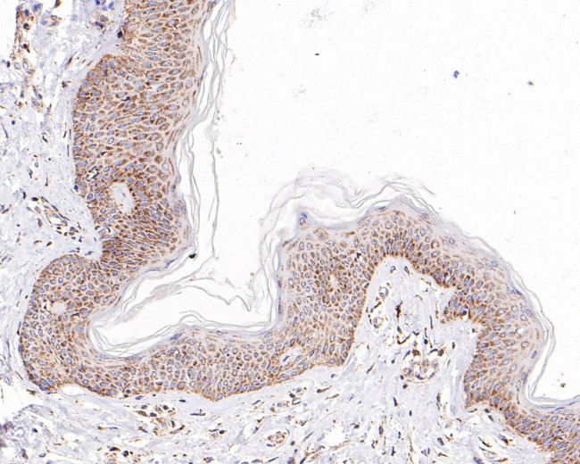 CD116 Antibody in Immunohistochemistry (Paraffin) (IHC (P))