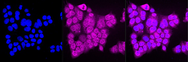 Calnexin Antibody in Immunocytochemistry (ICC/IF)