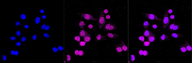 SHP2 Antibody in Immunocytochemistry (ICC/IF)