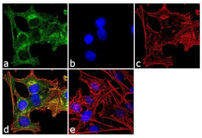 Tau Antibody in Immunocytochemistry (ICC/IF)