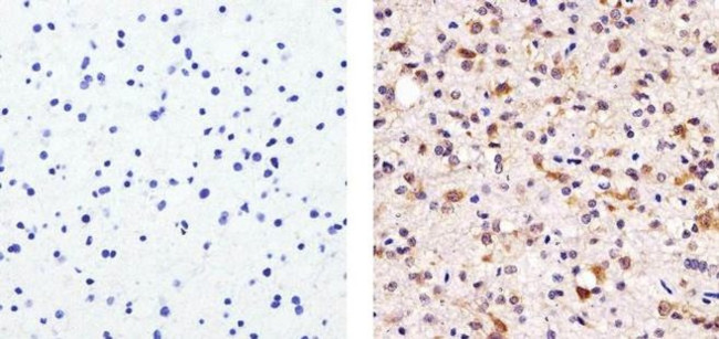 Tau Antibody in Immunohistochemistry (Paraffin) (IHC (P))